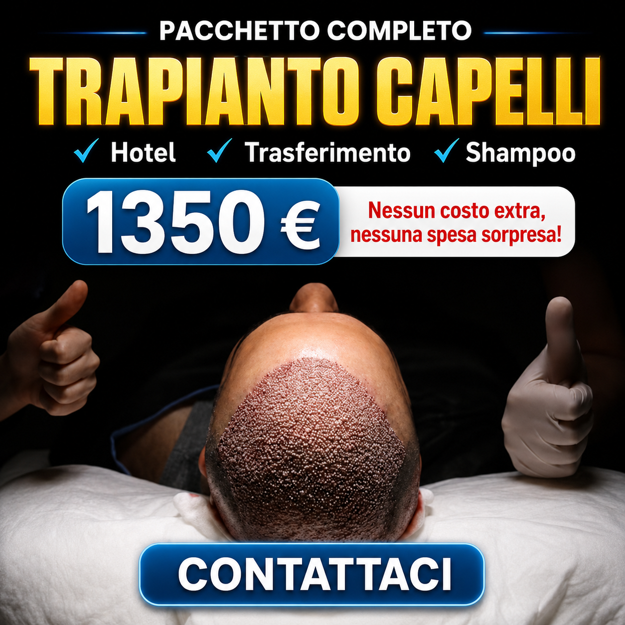 Trapianto capelli a Tirana